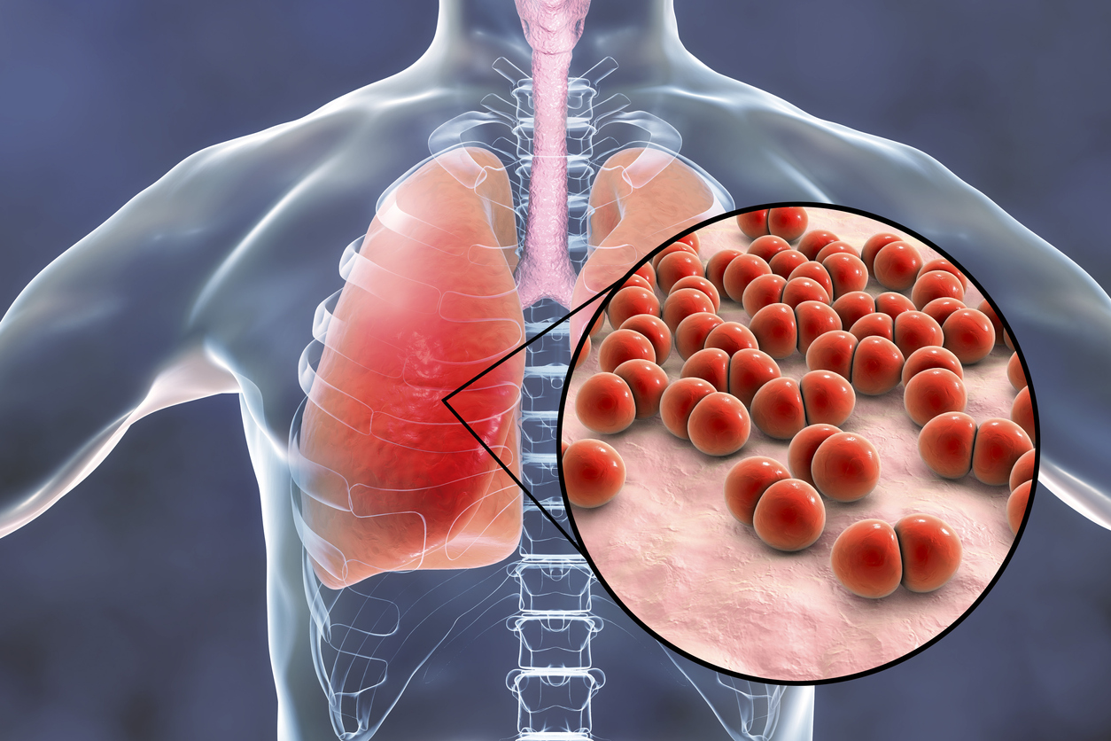 Pneumokocker